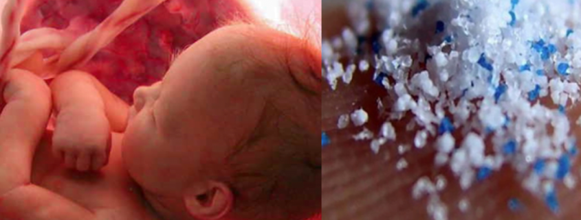 microplastics in human placenta